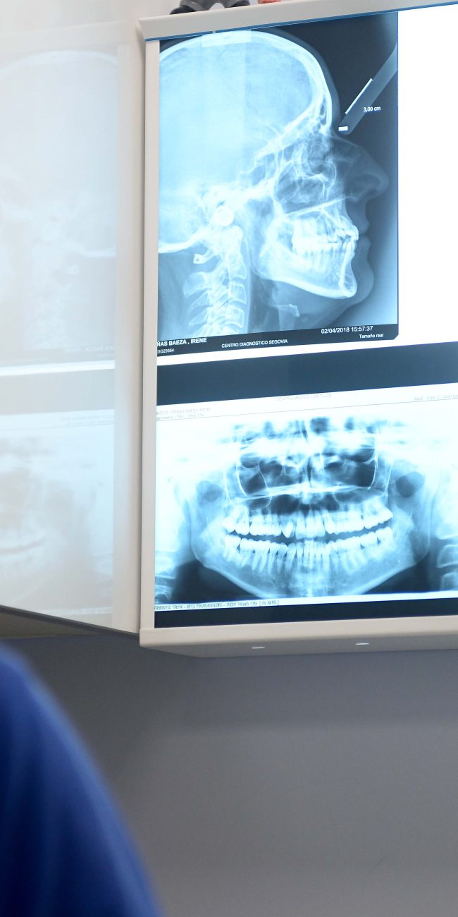 Periodoncia